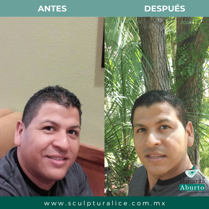 Paquete 3 Barras Sculptural Ice Facial