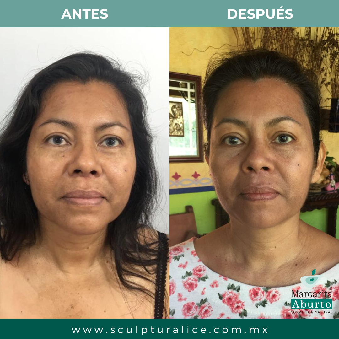 Paquete 3 Barras Sculptural Ice Facial