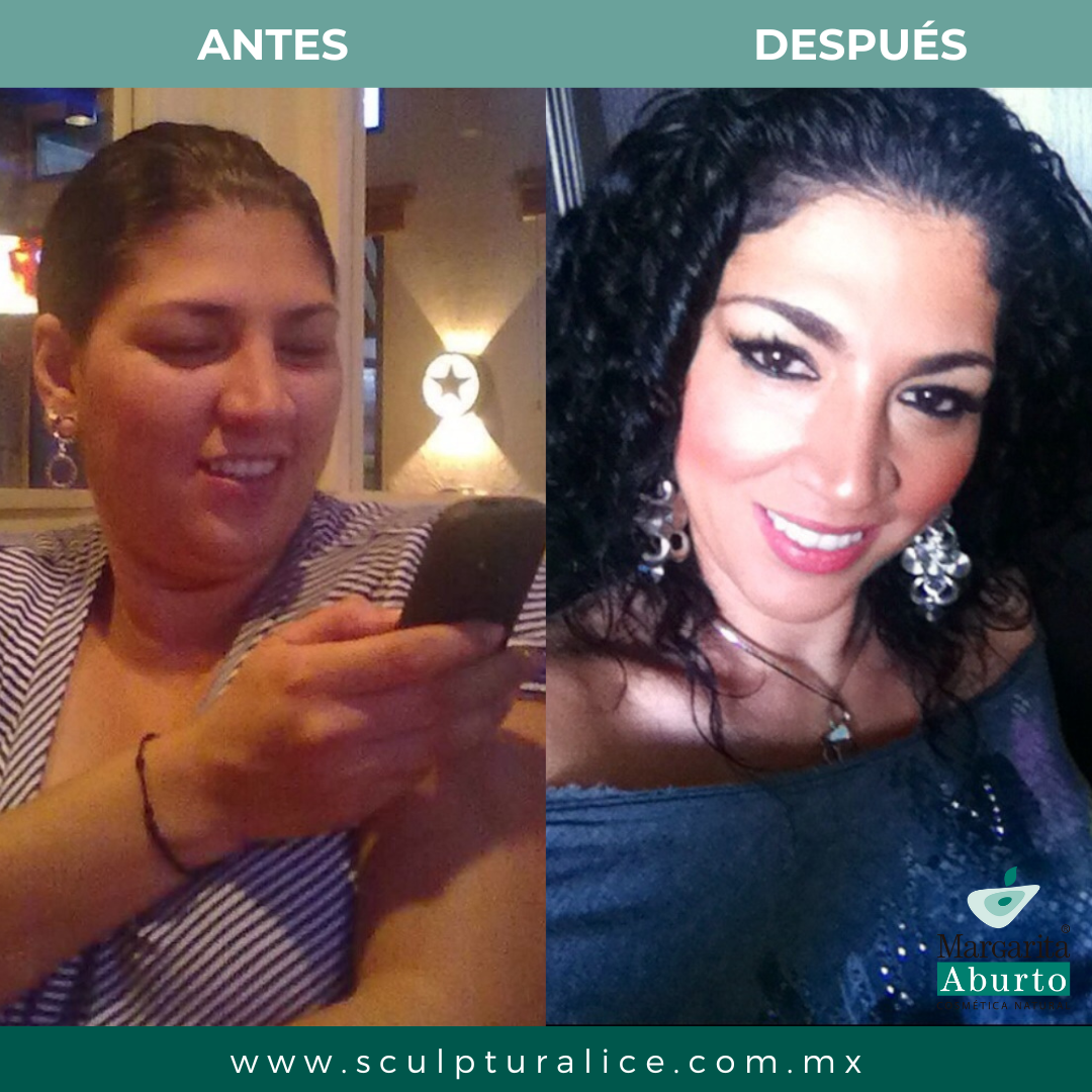 Paquete 3 Barras Sculptural Ice Facial